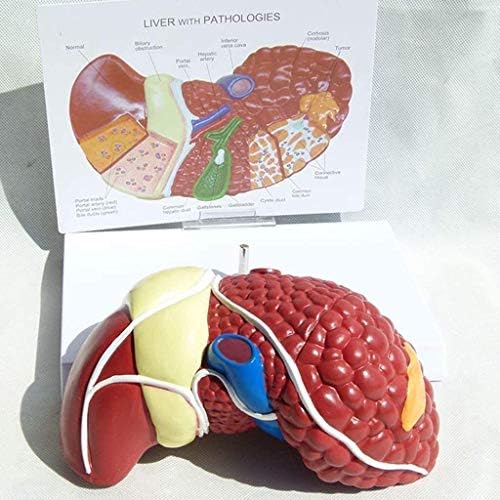 RRGJ Oktatási Modell Szerkezete a Tudomány Anatómia Zsigeri Modellek 3D Anatómiai Kóros Máj Anatómiai Modell Orvosi