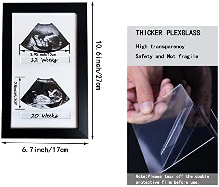 Ultrahang Képkeretek,Ultrahangos Kép Keret 2 Képeket,Ultrahang Keretek bébi,Bébi Ultrahang Kép, Terhesség Képkeret,Terhesség